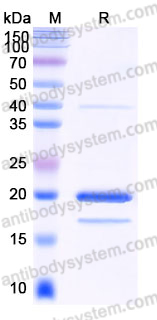 YHJ74202, SDS-PAGE