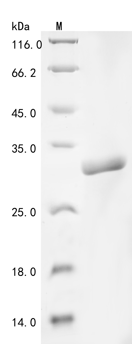 SDS-PAGE