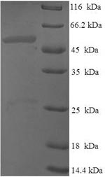 SDS-PAGE