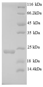 SDS-PAGE