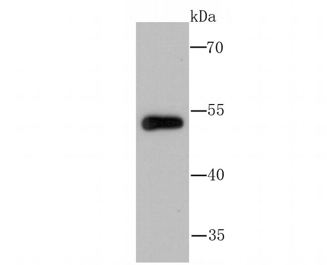Валидация AssayVector ARM1383(1072)