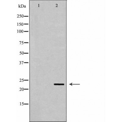 Валидация Affinity DF6774 - 18343