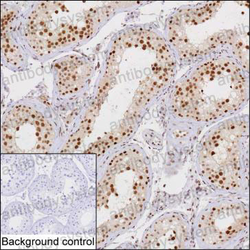 Валидация AntibodySystem RHP04101