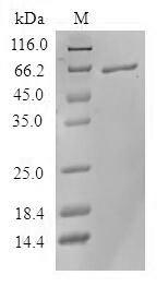 SDS-PAGE
