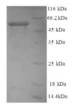 SDS-PAGE