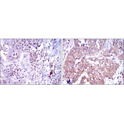 Валидация Affinity BF0466 - 5268