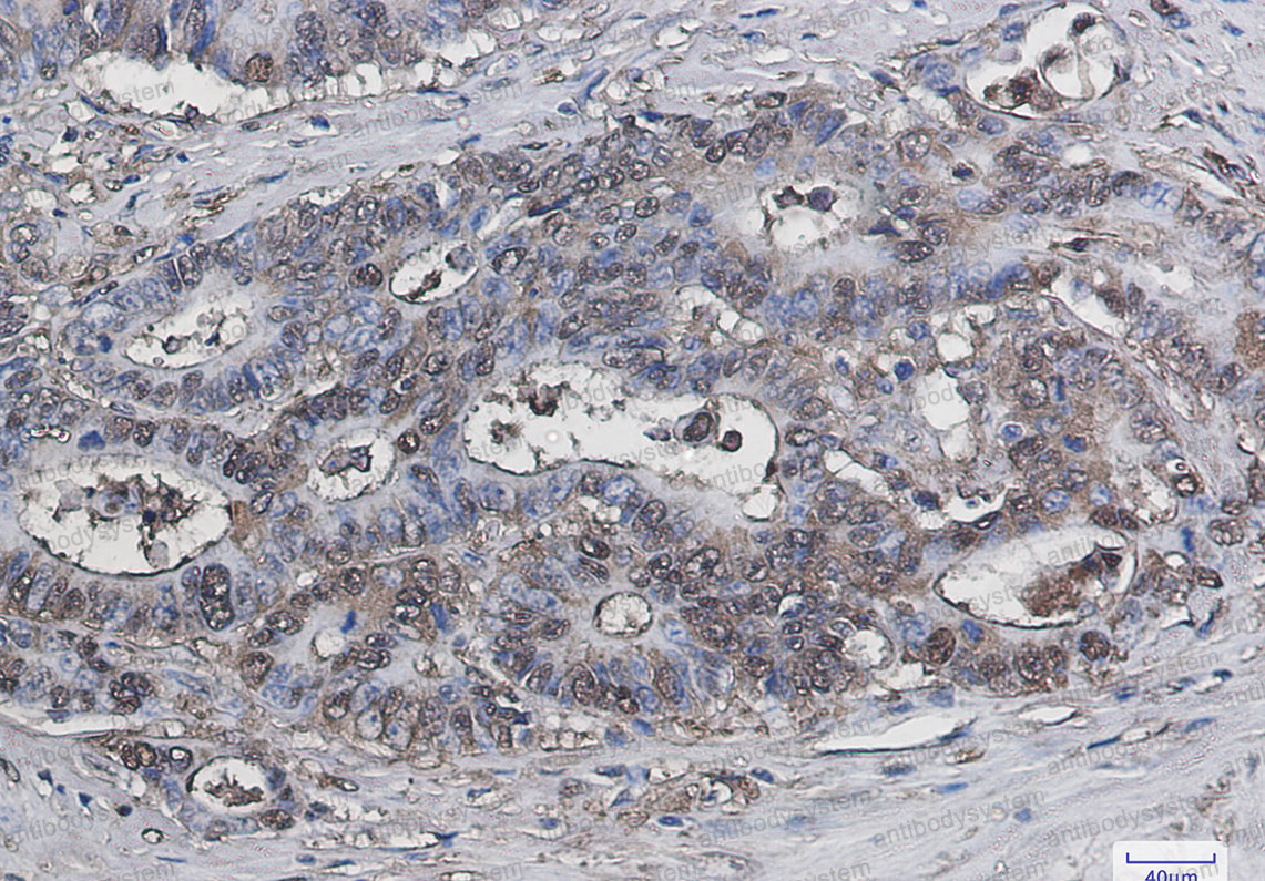 Валидация AntibodySystem RHD27105