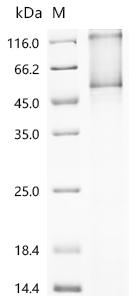 SDS-PAGE