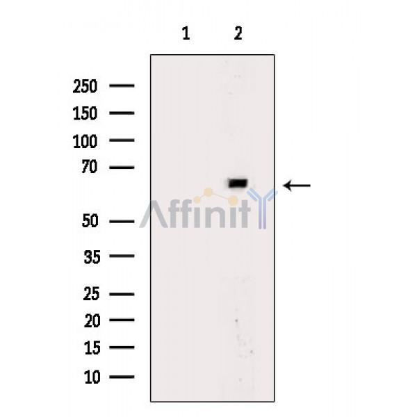 Валидация Affinity DF8727 - 20741
