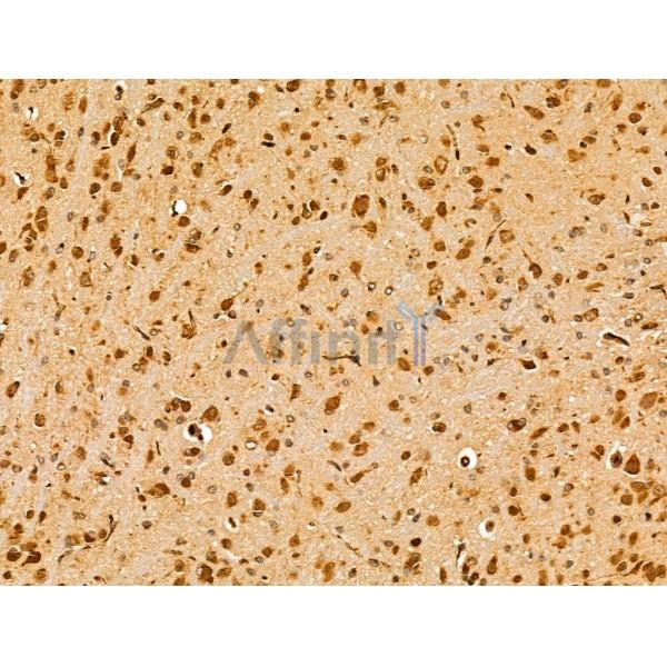 Валидация Affinity DF13598 - 9087