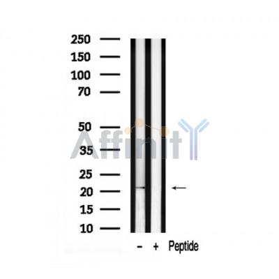 Валидация Affinity AF7945 - 4699