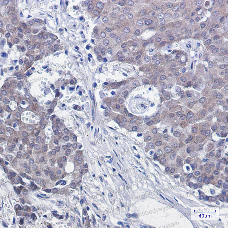 Валидация AntibodySystem RHH21701