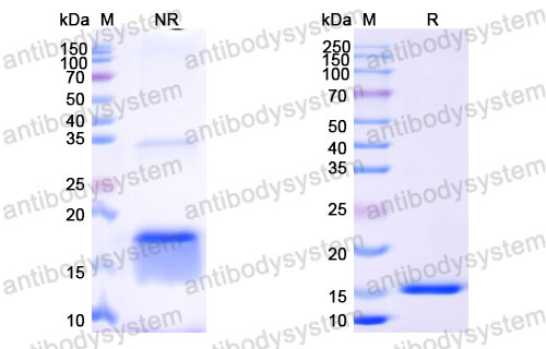 Валидация SDS-PAGE - AntibodySystem RHB86904
