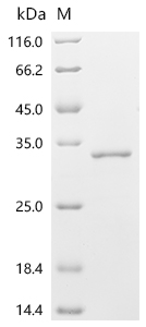 SDS-PAGE