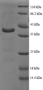SDS-PAGE
