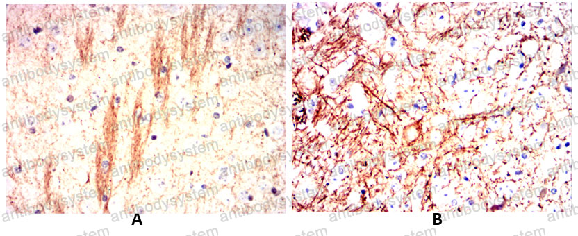 Валидация AntibodySystem RHC23301 (802)