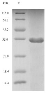 SDS-PAGE