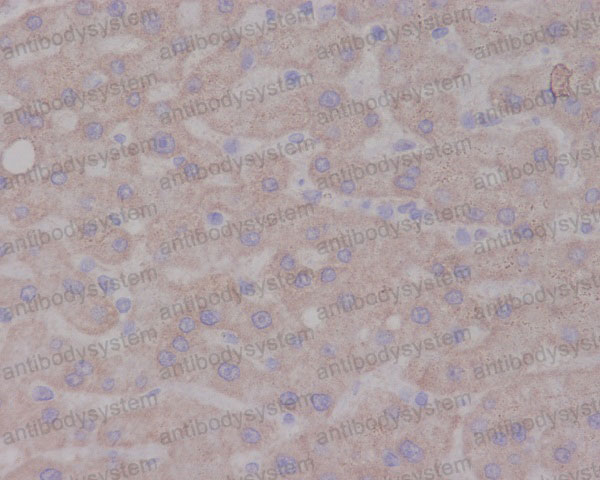 Валидация AntibodySystem RHC09801 (615)