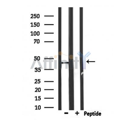 Валидация Affinity DF10058 - 5526