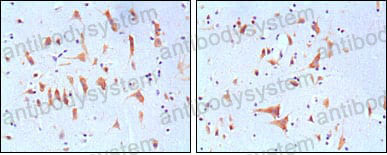 Валидация AntibodySystem RHG10304