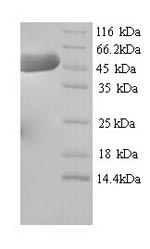 SDS-PAGE