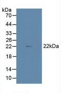 5575