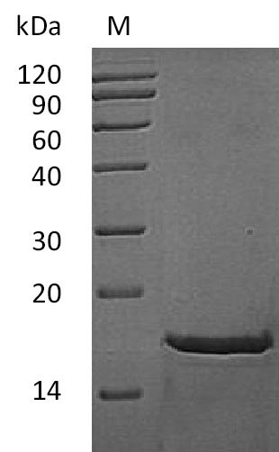 SDS-PAGE
