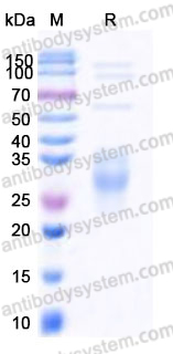YHD58901, SDS-PAGE