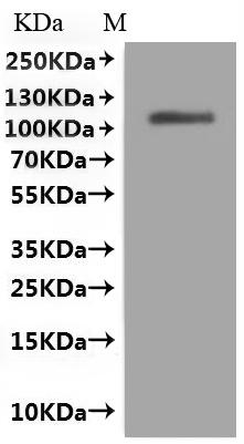 SDS-PAGE