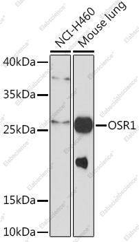 Вестерн-блоттинг, OSR1, различные клеточные линии