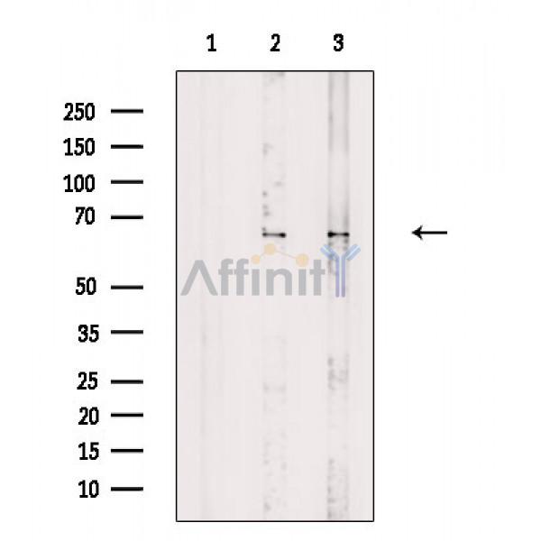 Валидация Affinity DF8794 - 20828