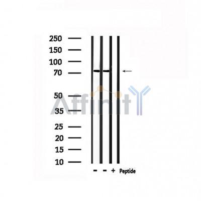 Валидация Affinity DF6274 - 17576