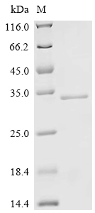 SDS-PAGE