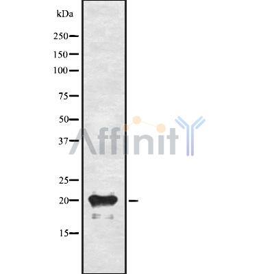 Валидация Affinity DF8501 - 20356