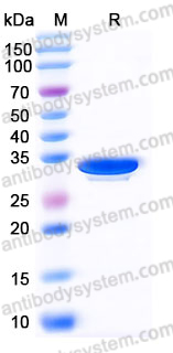 EHJ93103, SDS-PAGE