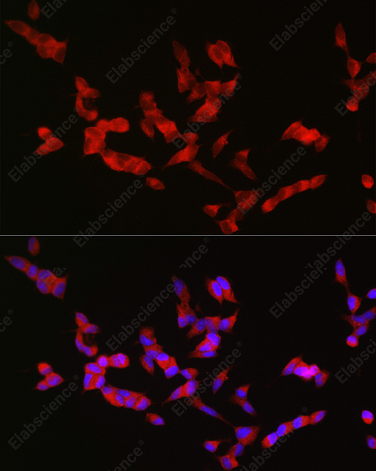 Иммунофлуоресценция, BSN, клетки SH-SY5Y