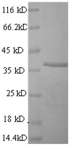 SDS-PAGE
