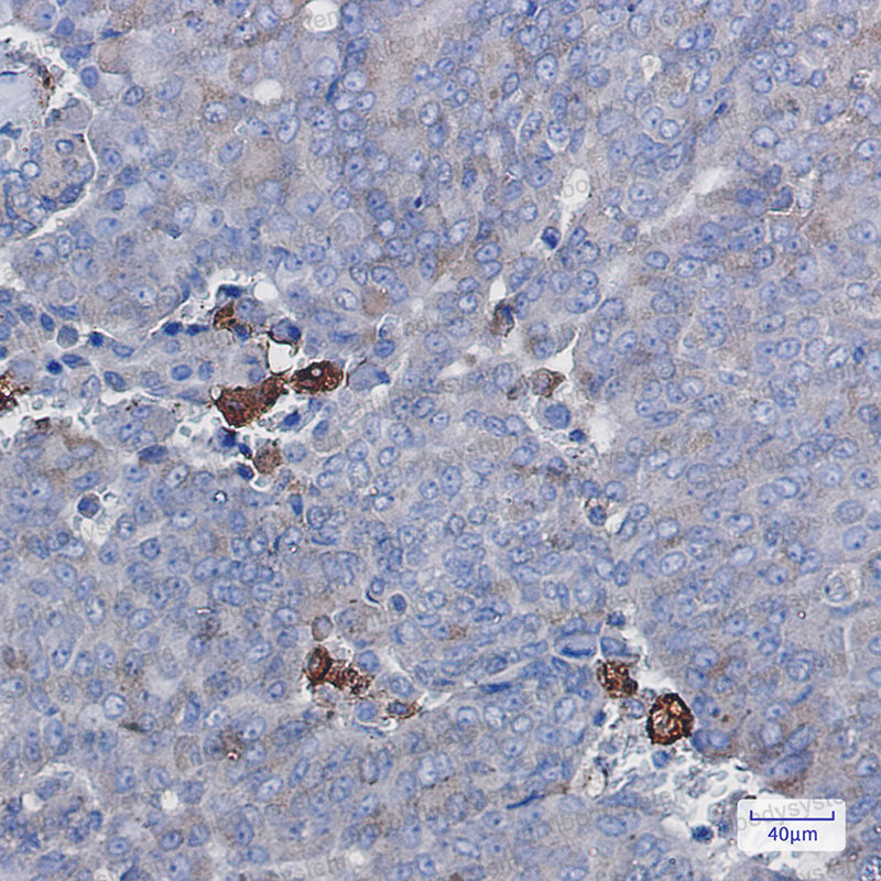 Валидация AntibodySystem RHC12515