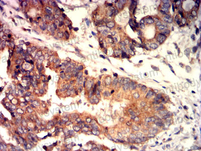 Валидация AntibodySystem RHJ55601