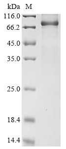 SDS-PAGE