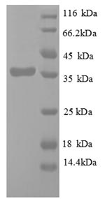 SDS-PAGE