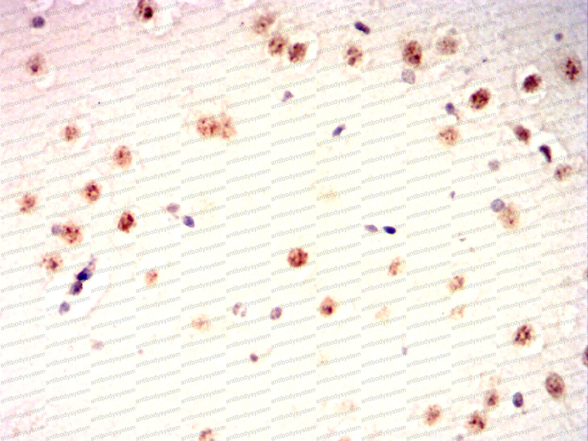 Валидация AntibodySystem RHF42903