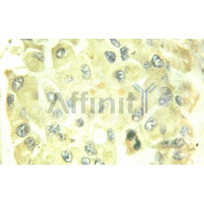 Валидация Affinity AF6171 - 3392