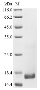 SDS-PAGE