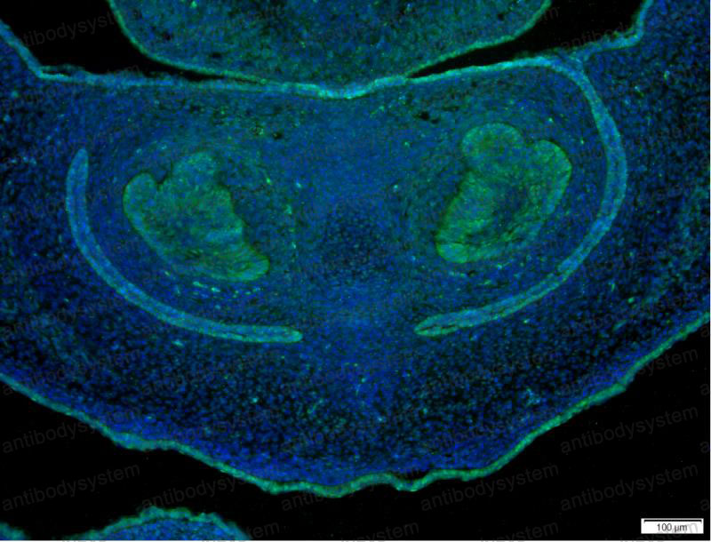 Валидация IF - AntibodySystem RHE50003