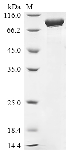SDS-PAGE