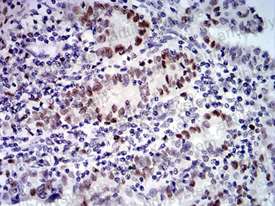 Валидация AntibodySystem RHK46902