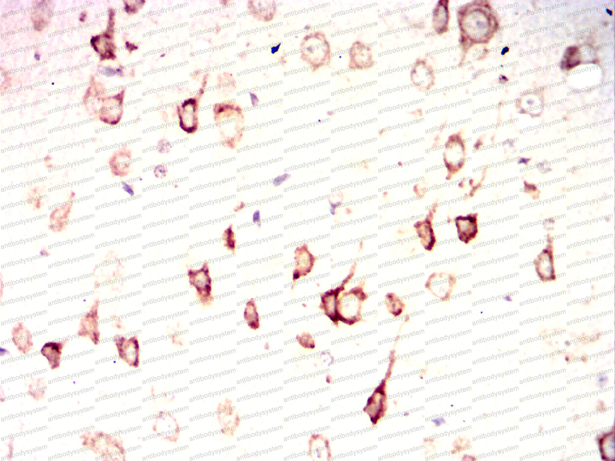 Валидация AntibodySystem RHC84902 (1114)