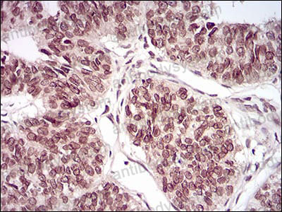 Валидация AntibodySystem RHF18201 (2478)