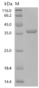 SDS-PAGE